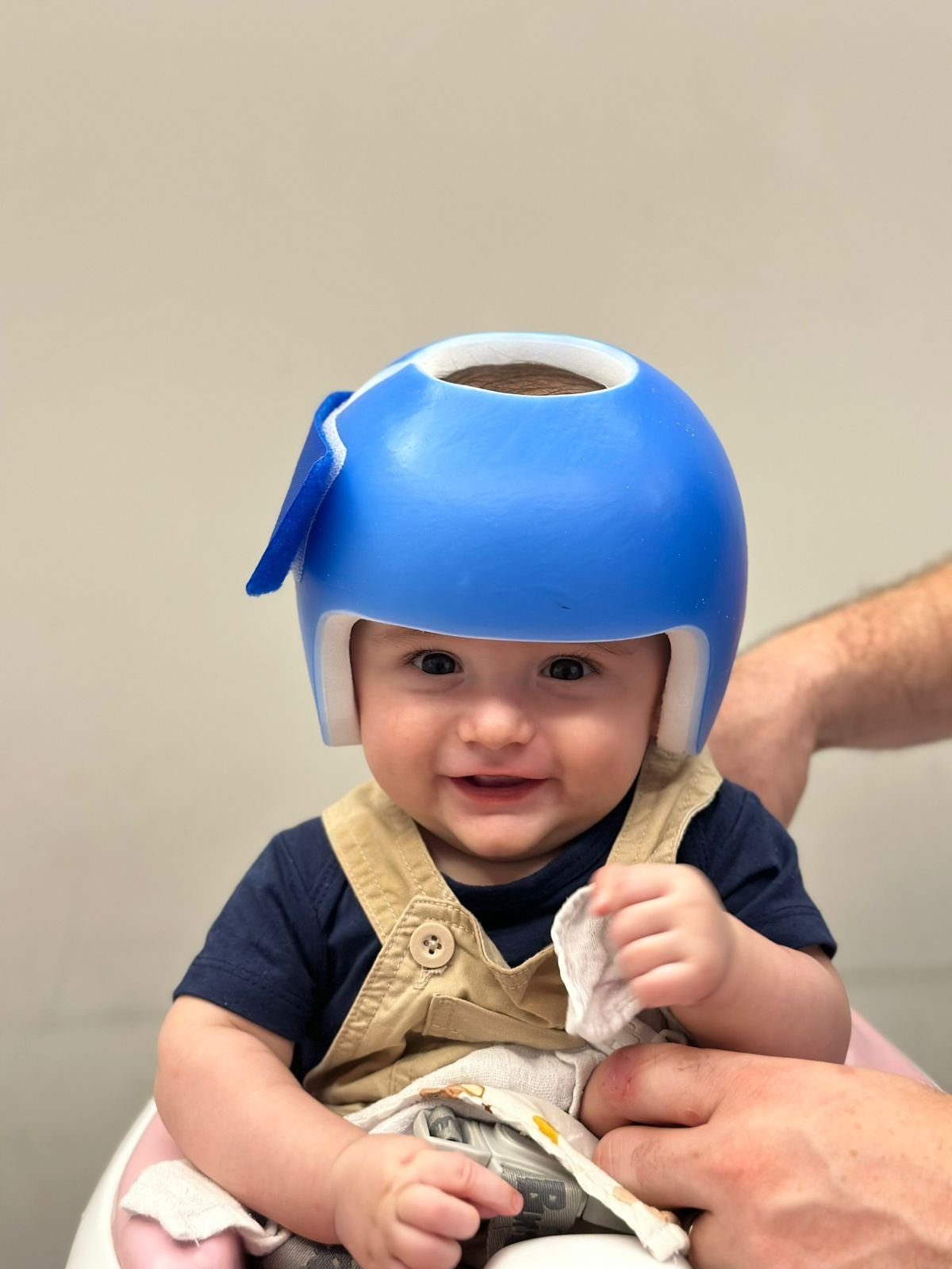 Assimetria craniana posicional: entenda!