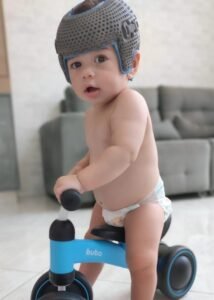 tratamento de assimetrias cranianas com órtese 3D